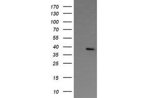 Image no. 1 for anti-Nudix (Nucleoside Diphosphate Linked Moiety X)-Type Motif 9 (NUDT9) antibody (ABIN1499875) (NUDT9 抗体)