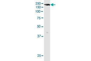 KDM6A monoclonal antibody (M05), clone 4E7.