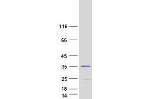 Western Blotting (WB) image for Spindlin 2B (SPIN2B) (Transcript Variant 3) protein (Myc-DYKDDDDK Tag) (ABIN2732587)