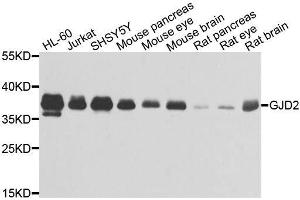 Western blot analysis of extracts of various cell lines, using GJD2 antibody. (GJD2 抗体  (AA 99-197))