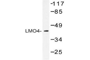Western blot (WB) analysis of LMO4 antibody in extracts from 293 cells. (LMO4 抗体)