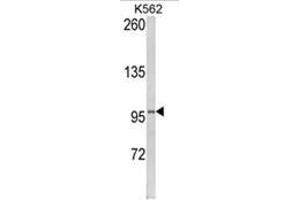 Western blot analysis of LPIN2 Antibody (Lipin 2 抗体  (Middle Region))
