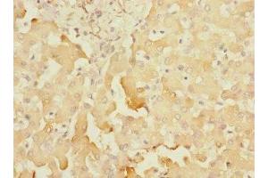 Immunohistochemistry of paraffin-embedded human liver tissue using ABIN7170776 at dilution of 1:100