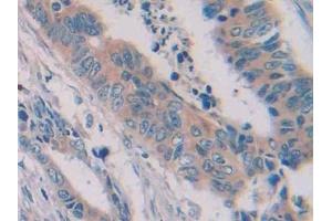 Immunohistochemistry (IHC) image for anti-PTK7 Protein tyrosine Kinase 7 (PTK7) (AA 853-1070) antibody (ABIN7445414)