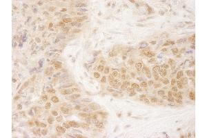 Immunohistochemistry (IHC) image for anti-Kinesin Family Member 2C (KIF2C) (AA 50-100) antibody (ABIN7448646)