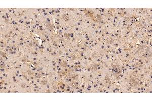 Detection of SST in Rat Cerebrum Tissue using Polyclonal Antibody to Somatostatin (SST) (Somatostatin 抗体  (AA 27-116))