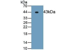 Detection of Recombinant ERK2, Human using Polyclonal Antibody to Extracellular Signal Regulated Kinase 2 (ERK2) (ERK2 抗体  (AA 104-342))