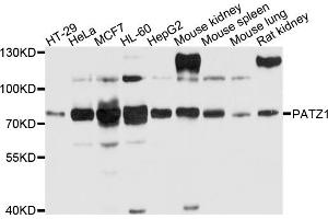 Western blot analysis of extracts of various cell lines, using PATZ1 antibody (ABIN4904681) at 1:1000 dilution. (PATZ1 抗体)