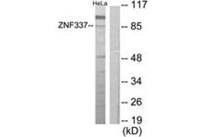 Western blot analysis of extracts from HeLa cells, using ZNF337 Antibody. (ZNF337 抗体  (AA 471-520))