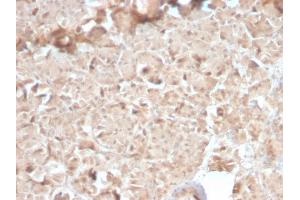 Formalin-fixed, paraffin-embedded human Pancreas stained with CELA3B Rabbit Recombinant Monoclonal Antibody (CELA3B/2810R). (Recombinant Elastase 3B 抗体  (AA 82-238))