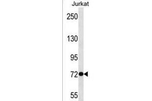ANKRD56 Antibody (Center) (ABIN1538405 and ABIN2850334) western blot analysis in Jurkat cell line lysates (35 μg/lane). (SOWAHB 抗体  (AA 412-438))