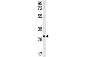 Western Blotting (WB) image for anti-Epithelial Cell Adhesion Molecule (EPCAM) (AA 57-85) antibody (ABIN3030858)