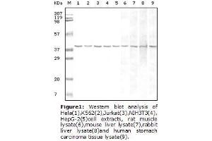 Image no. 1 for anti-Glyceraldehyde-3-Phosphate Dehydrogenase (GAPDH) antibody (ABIN207608) (GAPDH 抗体)