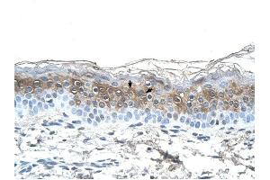 Fibrinogen Alpha antibody was used for immunohistochemistry at a concentration of 4-8 ug/ml to stain Squamous epithelial cells (arrows) in Human Skin. (FGA 抗体  (N-Term))