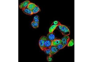 Confocal immunofluorescent analysis of CAF-1 Antibody (N-term)(Cat#AP50712PU-N) with HepG2 cell followed by Alexa Fluor 488-conjugated goat anti-rabbit lgG (green). (CNOT7 抗体  (N-Term))