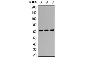 Western blot analysis of Pokemon expression in A549 (A), NS-1 (B), PC12 (C) whole cell lysates. (ZBTB7A 抗体  (Center))