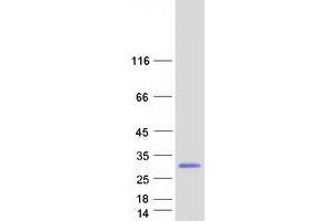 Western Blotting (WB) image for Ras Homolog Gene Family, Member C (RHOC) (Transcript Variant 2) protein (Myc-DYKDDDDK Tag) (ABIN2730852)