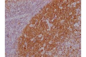 IHC image of ABIN7180562 diluted at 1:100 and staining in paraffin-embedded human lymph node tissue performed on a Leica BondTM system. (POU2AF1 抗体)