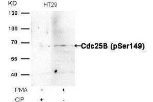 Western blot analysis of extracts from HT29 cells, treated with PMA or calf intestinal phosphatase (CIP), using Cdc25B (Phospho-Ser149) Antibody. (CDC25B 抗体  (pSer149))