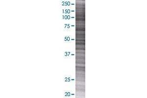 GAA transfected lysate. (GAA 293T Cell Transient Overexpression Lysate(Denatured))