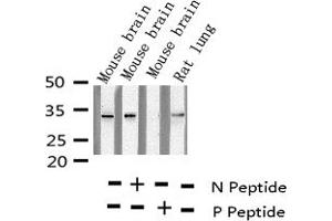 Western blot analysis of Phospho-S6 Ribosomal Protein (Ser235) expression in various lysates (RPS6 抗体  (pSer235))