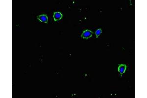 Immunofluorescent analysis of MCF-7 cells using ABIN7171961 at dilution of 1:100 and Alexa Fluor 488-congugated AffiniPure Goat Anti-Rabbit IgG(H+L) (TGFBR2 抗体  (AA 25-159))