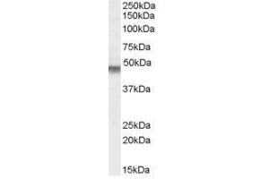 Image no. 1 for anti-Potassium Inwardly-Rectifying Channel, Subfamily J, Member 11 (KCNJ11) (Internal Region), (N-Term) antibody (ABIN374886) (KCNJ11 抗体  (Internal Region, N-Term))