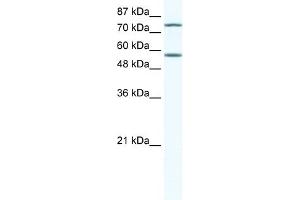 WB Suggested Anti-IRF4 Antibody Titration:  5ug/ml  Positive Control:  Jurkat cell lysate (IRF4 抗体  (N-Term))
