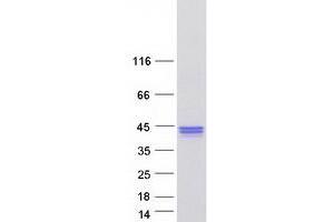 Western Blotting (WB) image for Pleckstrin Homology Domain Containing, Family F (With FYVE Domain) Member 1 (PLEKHF1) protein (Myc-DYKDDDDK Tag) (ABIN2729165)