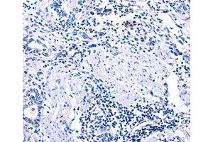 Immunohistochemistry (IHC) image for anti-DNA (Cytosine-5-)-Methyltransferase 3 alpha (DNMT3A) antibody (ABIN1872325) (DNMT3A 抗体)