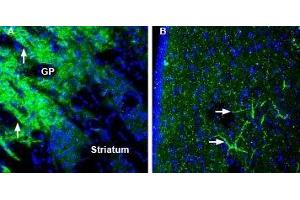 Expression of SynGAP in mouse globus pallidus and rat lateral septum - Immunohistochemical staining of perfusion-fixed frozen mouse and rat brain sections using Anti-SynGAP Antibody (ABIN7043789, ABIN7045176 and ABIN7045177), (1:200), followed by goat-anti-rabbit-AlexaFluor-488. (SYNGAP1 抗体  (C-Term))