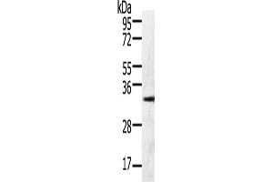 Gel: 10 % SDS-PAGE, Lysate: 60 μg, Lane: 293T cells, Primary antibody: ABIN7190790(GFRA4 Antibody) at dilution 1/600, Secondary antibody: Goat anti rabbit IgG at 1/8000 dilution, Exposure time: 30 seconds (GFRA4 抗体)