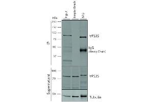 Immunoprecipitation (IP) image for anti-Vacuolar Protein Sorting 35 (VPS35) antibody (FITC) (ABIN6932974)