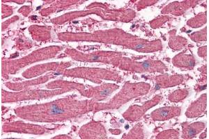 Human Heart: Formalin-Fixed, Paraffin-Embedded (FFPE) (EDEM2 抗体  (AA 479-579))