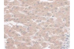 IHC-P analysis of Human Liver Tissue, with DAB staining. (SYNE2 抗体  (AA 6-296))