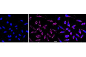 Immunocytochemical staining of HepG2 cells with Mitochondrial ribosomal protein S15 antibody (ABIN7799432), 1:1,000). (Recombinant MRPS15 抗体)