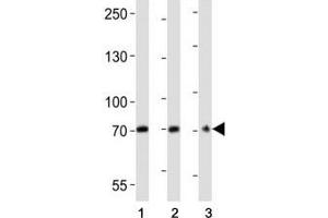 Western blot analysis of lysate from (1) U266, (2) HepG2 cell line, (3) mouse brain tissue lysate using CD73 antibody at 1:2000. (CD73 抗体  (AA 520-550))