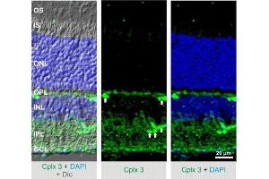 Indirect immunostaining of mouse retina (dilution 1 : 500). (CPLX3 抗体)
