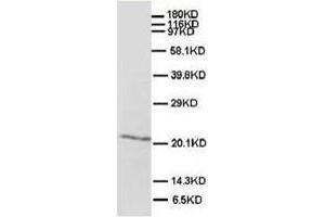Western blot analysis of rat brain tissue lysis using SHH antibody (Sonic Hedgehog 抗体  (N-Term))