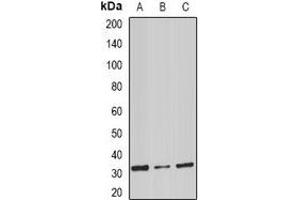 Western blot analysis of Stomatin expression in mouse spleen (A), mouse heart (B), rat liver (C) whole cell lysates.