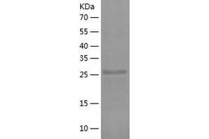 NPM1 Protein (AA 1-292) (His tag)