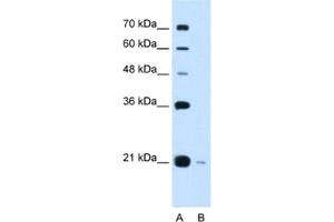 Western Blotting (WB) image for anti-DCTP Pyrophosphatase 1 (DCTPP1) antibody (ABIN2462972) (DCTPP1 抗体)