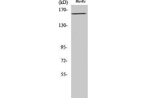 Western Blot (WB) analysis of specific cells using Phospho-Flk-1 (Y1175) Polyclonal Antibody. (VEGFR2/CD309 抗体  (pTyr1175))