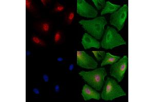 ABIN6259146 and ABIN6273735 staining  cells by IF/ICC. (PAX4 抗体  (Internal Region))