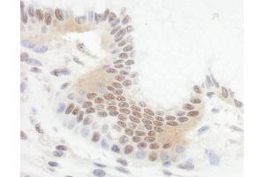 Immunohistochemistry (IHC) image for anti-B-Cell CLL/lymphoma 11B (Zinc Finger Protein) (BCL11B) (AA 500-550) antibody (ABIN7454621) (BCL11B 抗体  (AA 500-550))