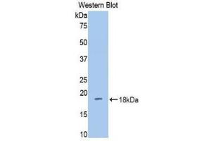 Western Blotting (WB) image for anti-Dipeptidyl-Peptidase 4 (DPP4) (AA 631-760) antibody (ABIN1858663) (DPP4 抗体  (AA 631-760))