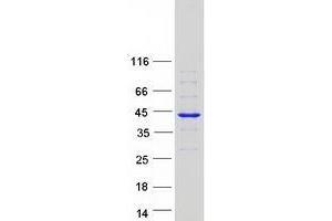 Western Blotting (WB) image for ZW10 Interactor (ZWINT) (Transcript Variant 1) protein (Myc-DYKDDDDK Tag) (ABIN2736190)