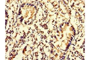 Immunohistochemistry of paraffin-embedded human appendix tissue using ABIN7150849 at dilution of 1:100 (DNAAF3 抗体  (AA 1-209))