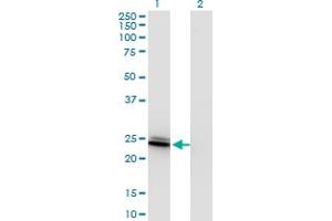 Western Blot analysis of BIN3 expression in transfected 293T cell line by BIN3 monoclonal antibody (M09), clone 4E12. (BIN3 抗体  (AA 154-253))