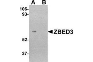 Western blot analysis of ZBED3 in human lung tissue lysate with this product at 1 μg/ml in (A) the absence and (B) the presence of blocking peptide. (ZBED3 抗体  (C-Term))
